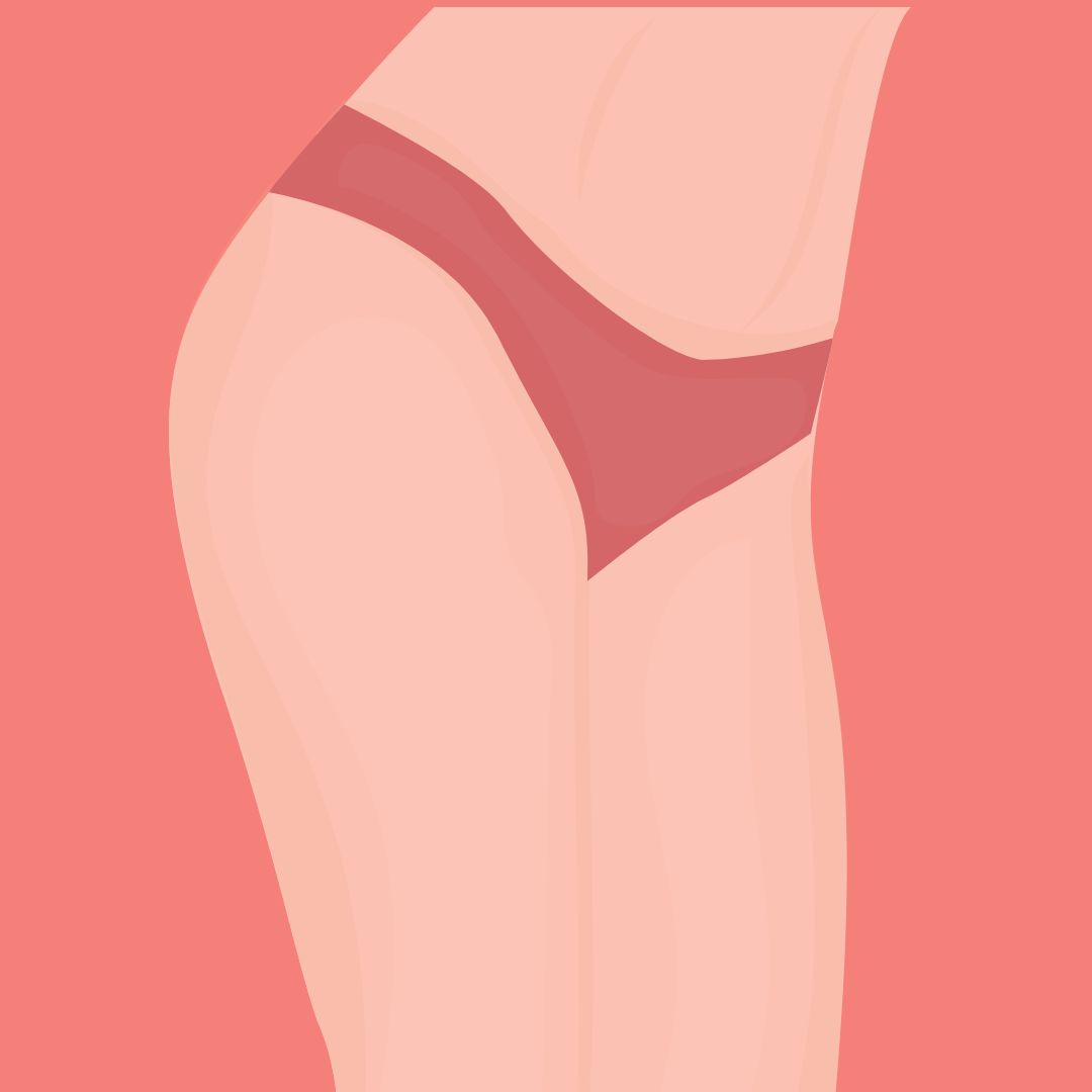 pcos darker inner thighs