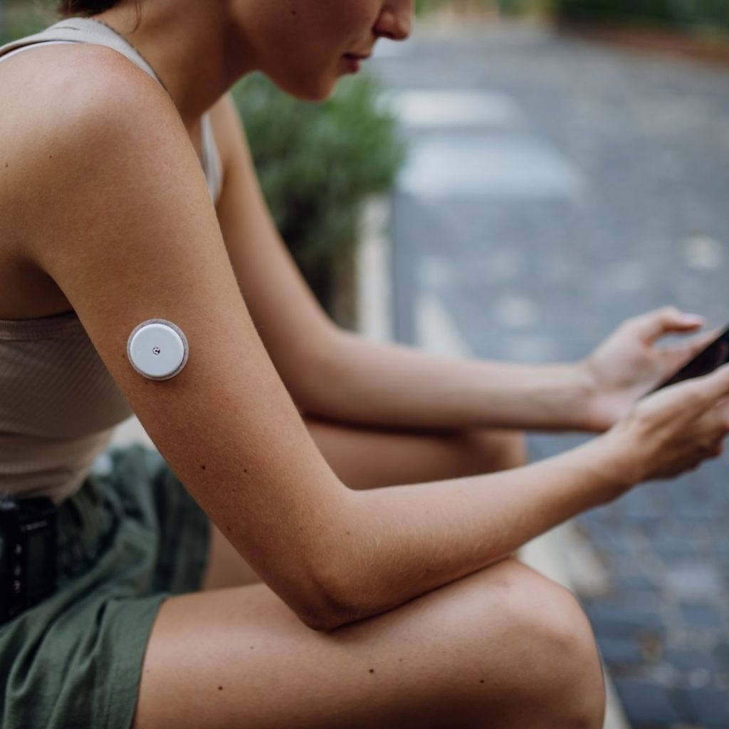 continuous glucose monitoring for pcos