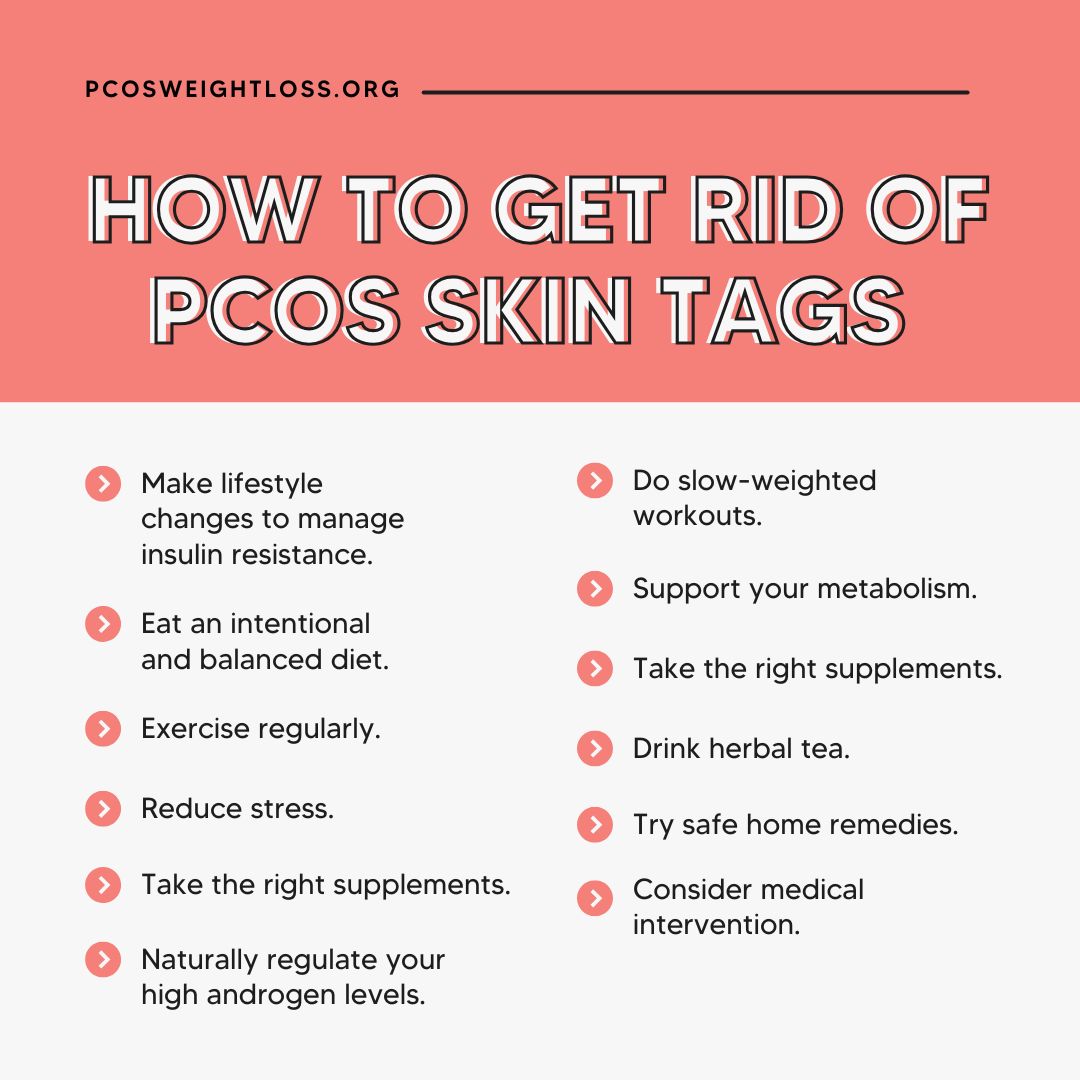 how to get rid of pcos skin tags
