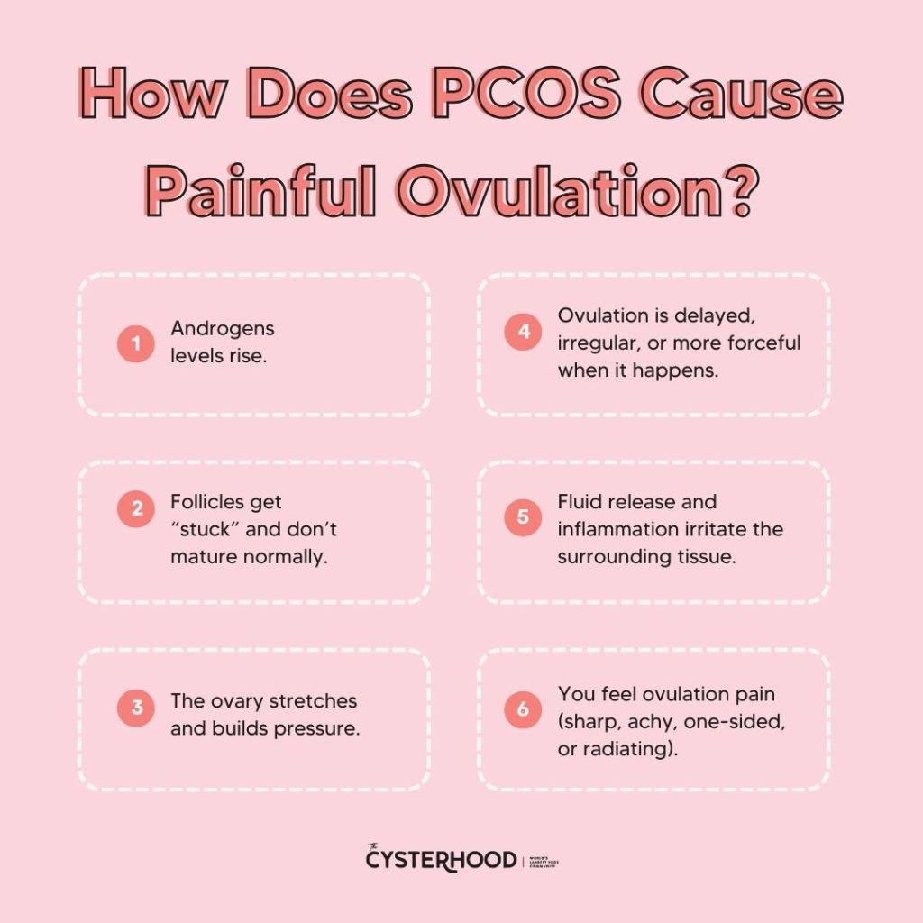 List of reasons on how PCOS can causes painful ovulation