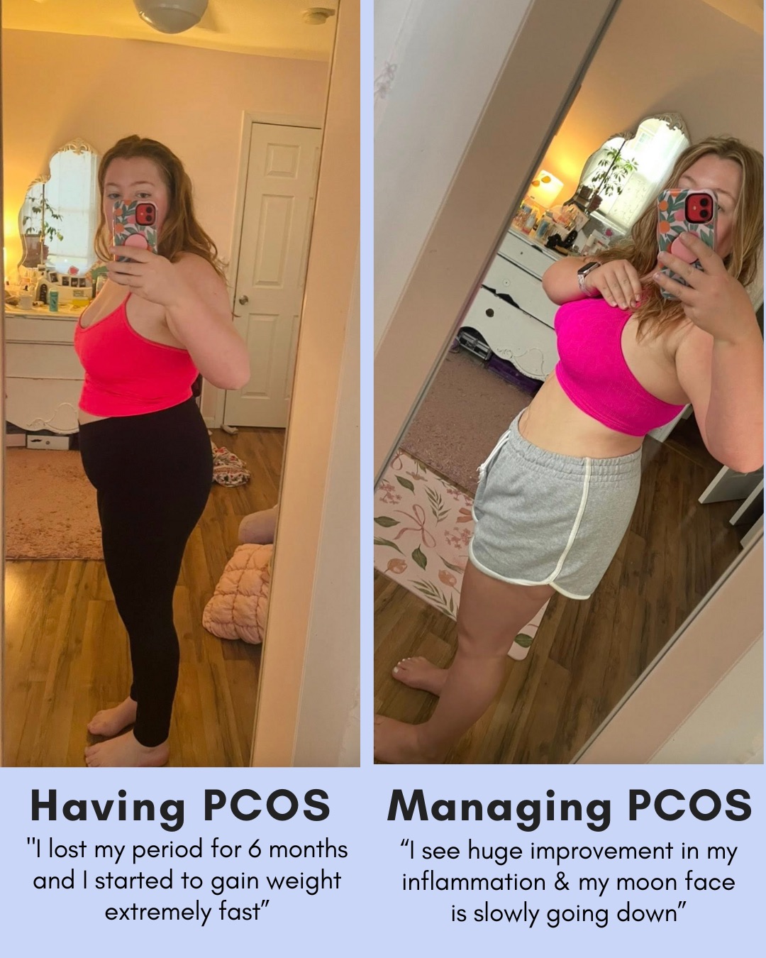 Side-by-side photos of a person in a pink sports bra: left shows weight gain with PCOS, right shows a slimmer silhouette after managing PCOS.