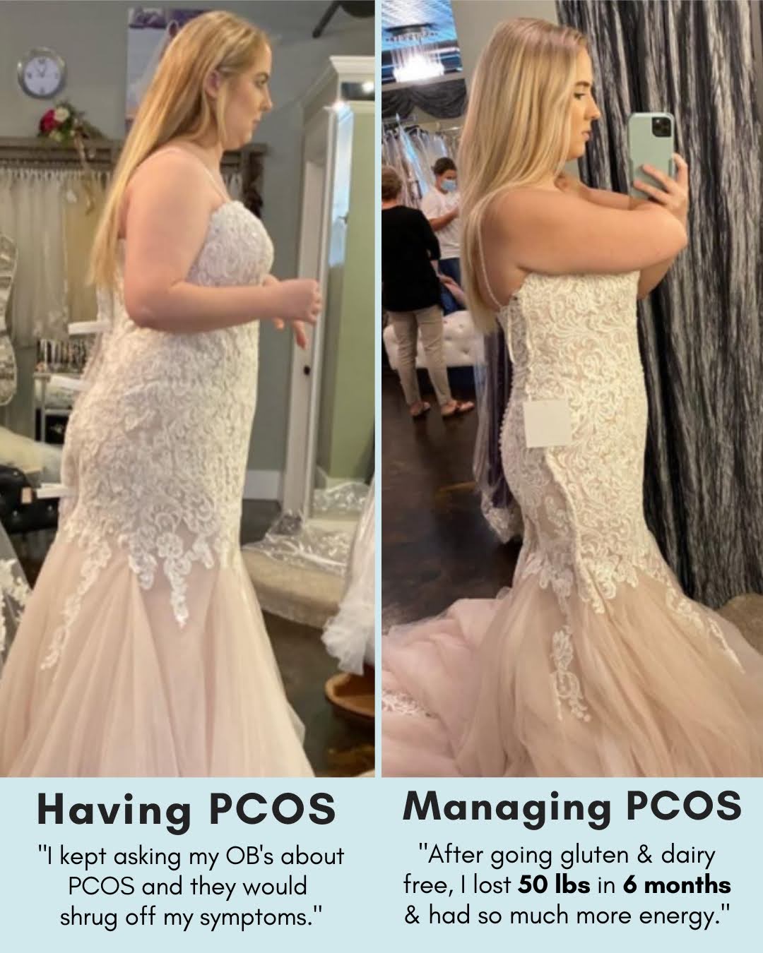 Side-by-side collage of a woman in a lace wedding gown: left panel shows a fuller figure in a fitting room labeled 'Having PCOS'; right panel shows a slimmer figure posing with a phone labeled 'Managing PCOS' in a fitting room.